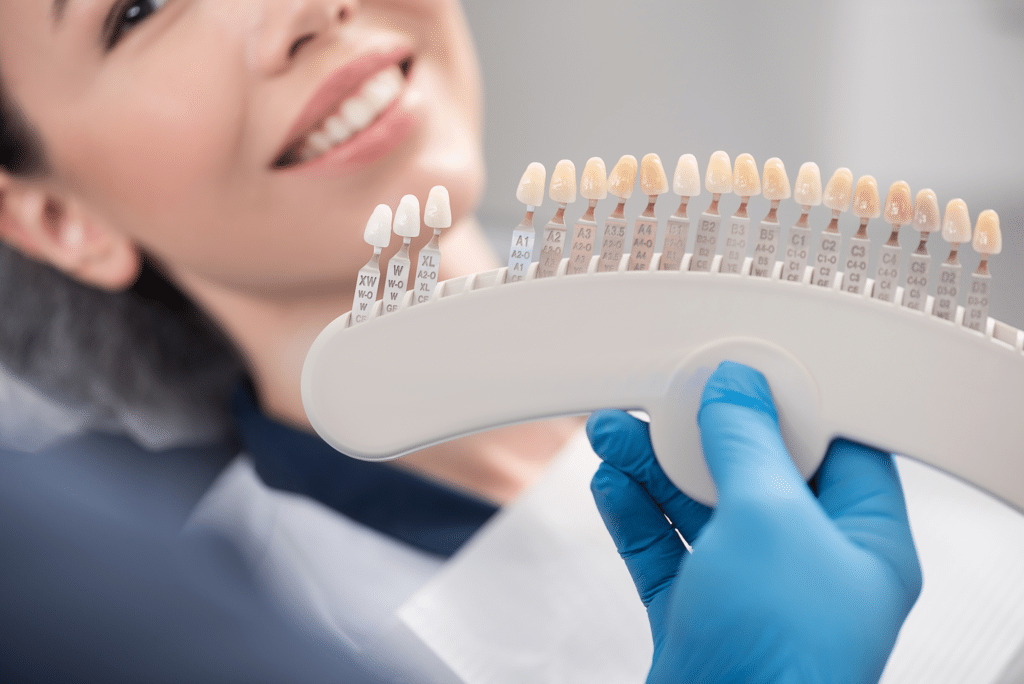 Teeth Whitening Or Veneers?