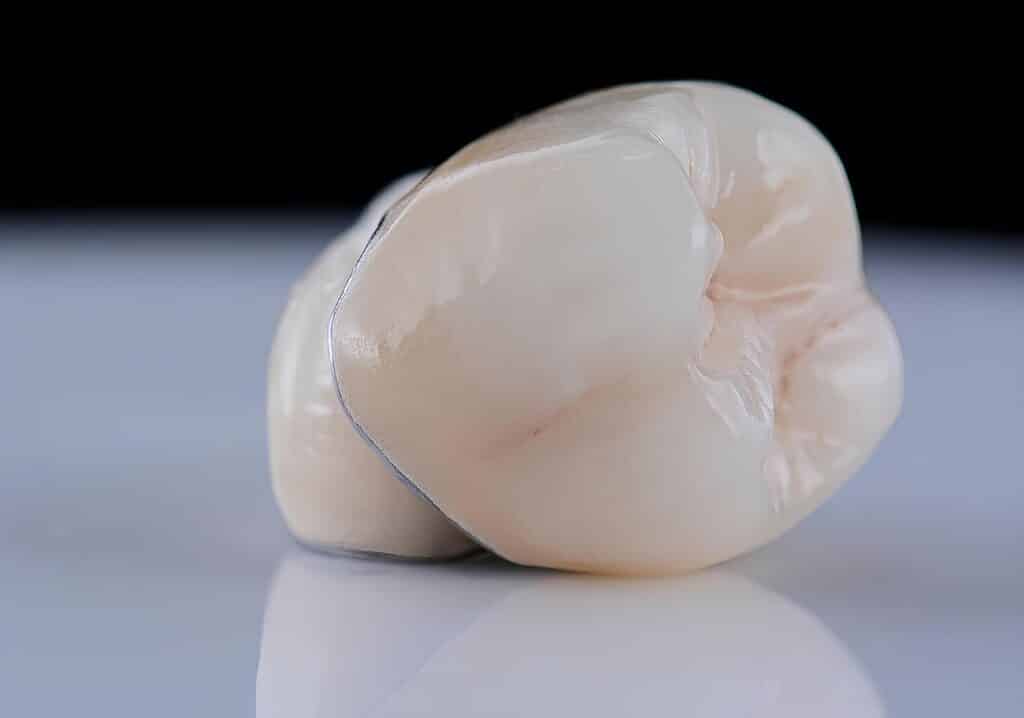 dental crowns ogden